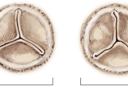 Correctly label the following parts of the heart valves